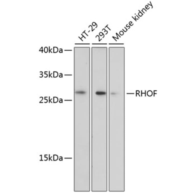 Western Blot - Anti-RhoF Antibody (A89016) - Antibodies.com