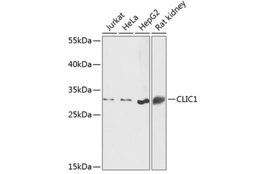 Western Blot - Anti-CLIC1 Antibody (A89017) - Antibodies.com
