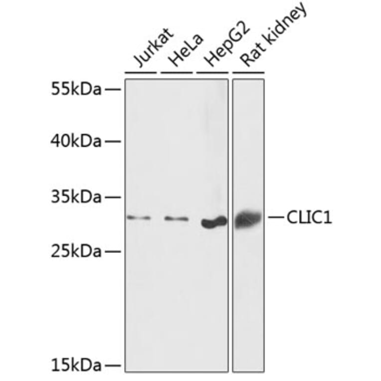 Western Blot - Anti-CLIC1 Antibody (A89017) - Antibodies.com