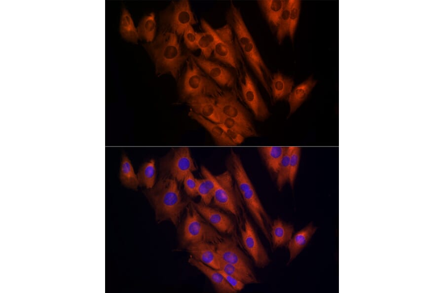 Immunofluorescence - Anti-CLIC1 Antibody (A89017) - Antibodies.com
