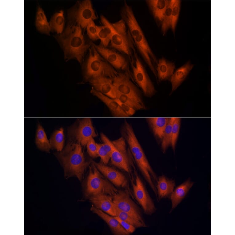 Immunofluorescence - Anti-CLIC1 Antibody (A89017) - Antibodies.com