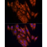 Immunofluorescence - Anti-CLIC1 Antibody (A89017) - Antibodies.com