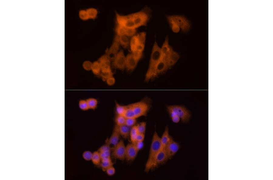 Immunofluorescence - Anti-CLIC1 Antibody (A89017) - Antibodies.com