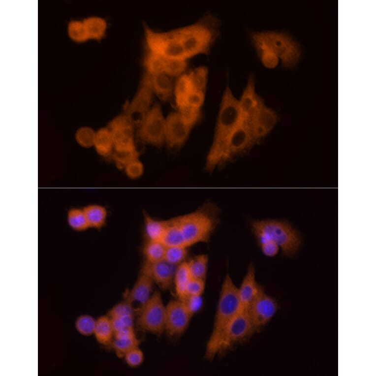 Immunofluorescence - Anti-CLIC1 Antibody (A89017) - Antibodies.com