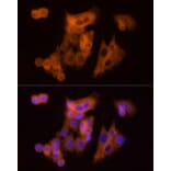 Immunofluorescence - Anti-CLIC1 Antibody (A89017) - Antibodies.com