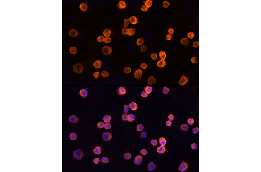 Immunofluorescence - Anti-CLIC1 Antibody (A89017) - Antibodies.com