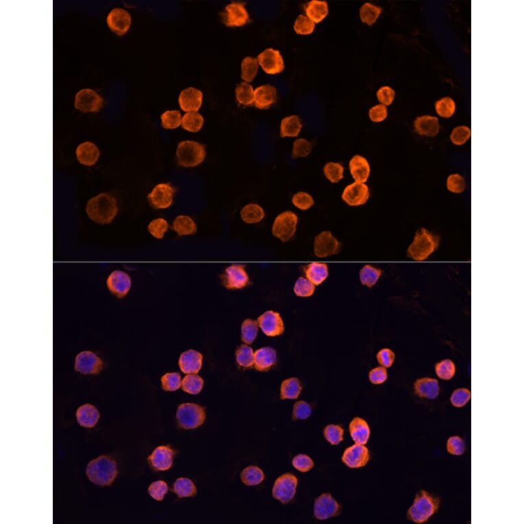 Immunofluorescence - Anti-CLIC1 Antibody (A89017) - Antibodies.com