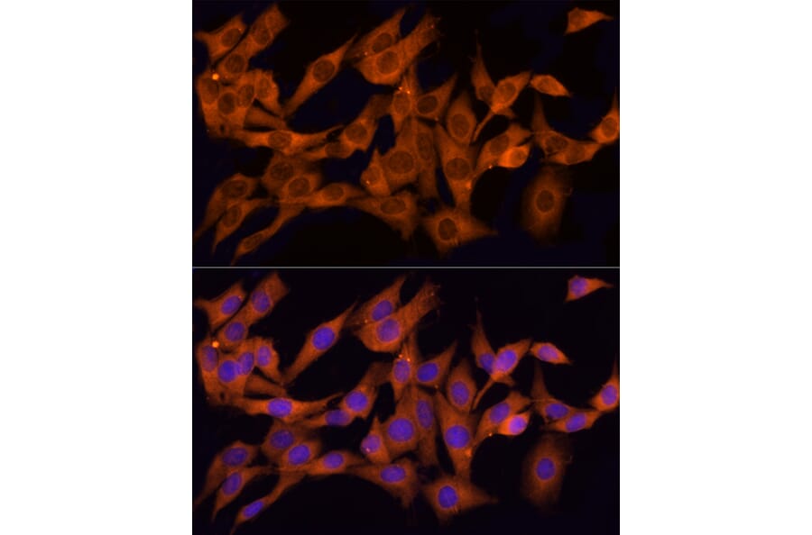 Immunofluorescence - Anti-CLIC1 Antibody (A89017) - Antibodies.com
