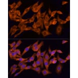 Immunofluorescence - Anti-CLIC1 Antibody (A89017) - Antibodies.com