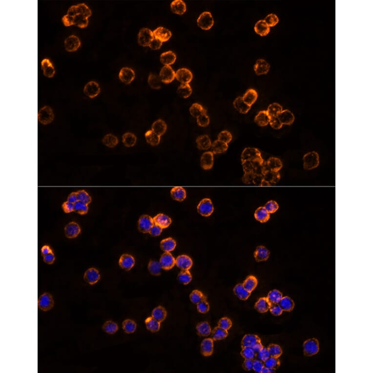 Immunofluorescence - Anti-CLIC1 Antibody (A89017) - Antibodies.com