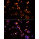 Immunofluorescence - Anti-CLIC1 Antibody (A89017) - Antibodies.com