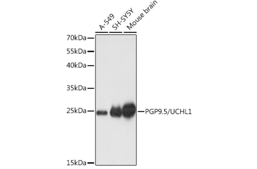 Western Blot - Anti-PGP9.5 Antibody (A89018) - Antibodies.com