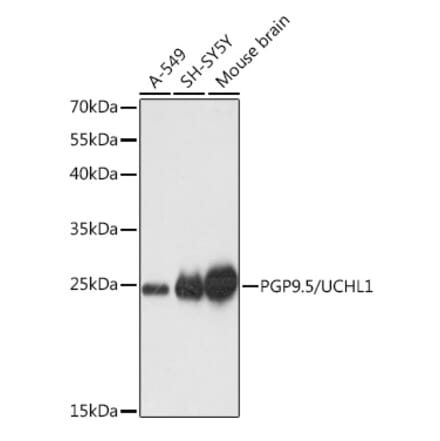 Western Blot - Anti-PGP9.5 Antibody (A89018) - Antibodies.com