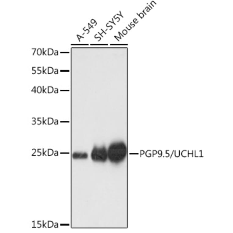 Western Blot - Anti-PGP9.5 Antibody (A89018) - Antibodies.com