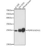 Western Blot - Anti-PGP9.5 Antibody (A89018) - Antibodies.com