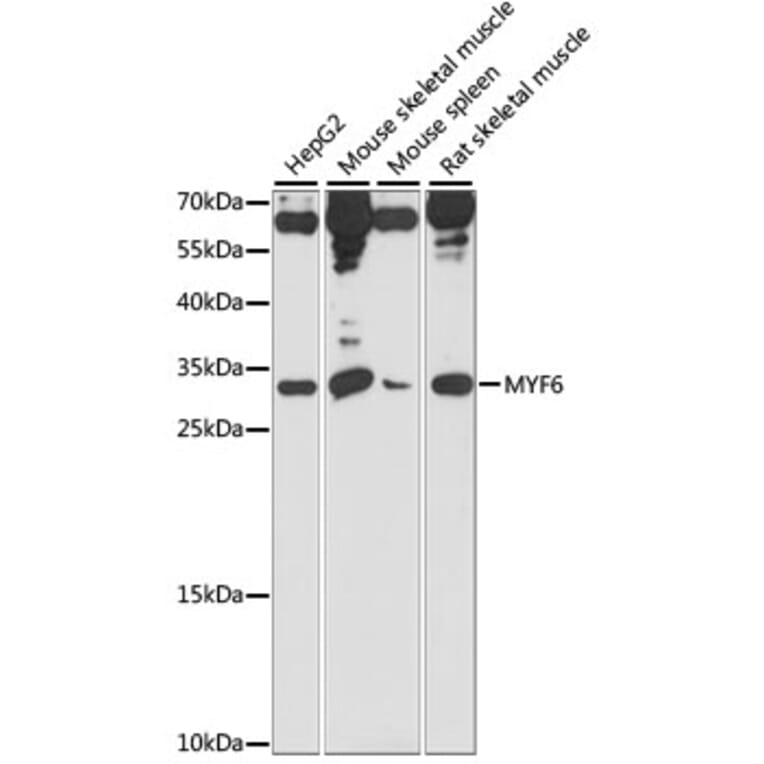 Western Blot - Anti-MYF6 Antibody (A89019) - Antibodies.com