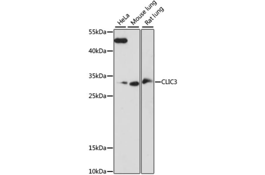 Western Blot - Anti-CLIC3 Antibody (A89020) - Antibodies.com