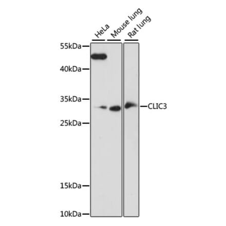 Western Blot - Anti-CLIC3 Antibody (A89020) - Antibodies.com