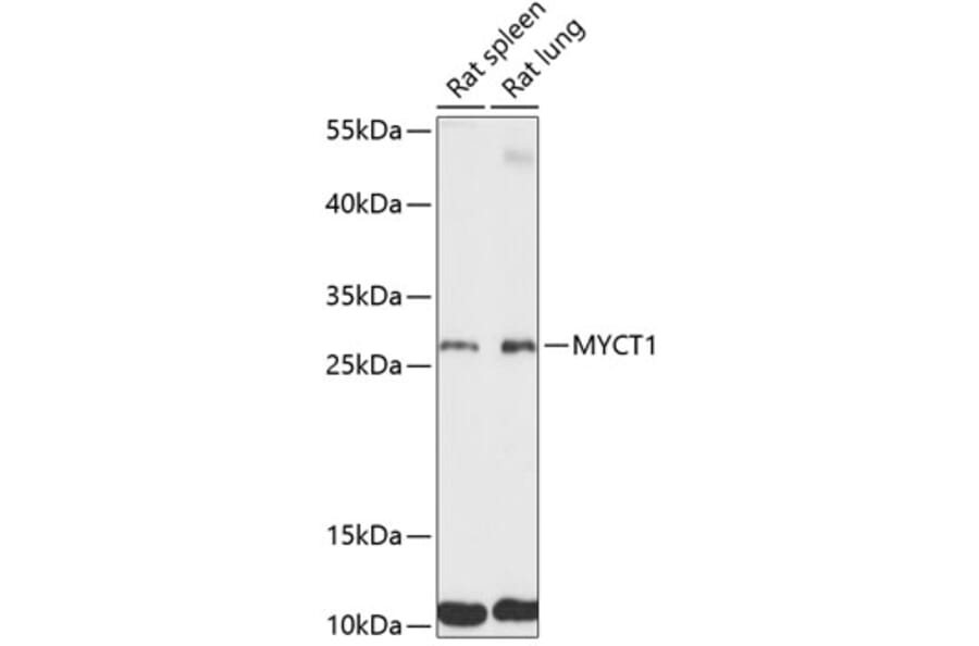 Western Blot - Anti-MYCT1 Antibody (A89021) - Antibodies.com
