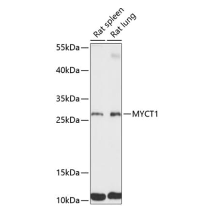 Western Blot - Anti-MYCT1 Antibody (A89021) - Antibodies.com