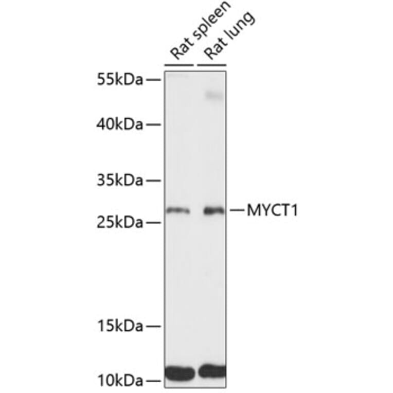 Western Blot - Anti-MYCT1 Antibody (A89021) - Antibodies.com