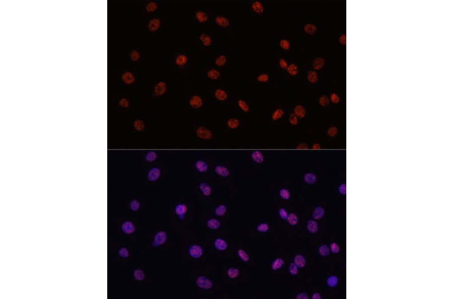 Immunofluorescence - Anti-MYCT1 Antibody (A89021) - Antibodies.com