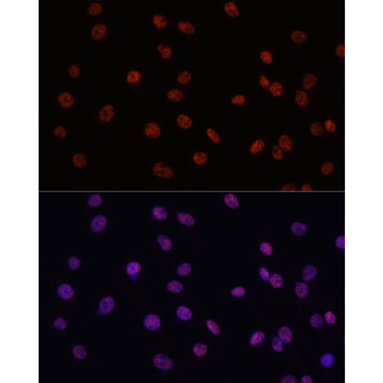 Immunofluorescence - Anti-MYCT1 Antibody (A89021) - Antibodies.com