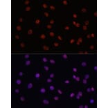 Immunofluorescence - Anti-MYCT1 Antibody (A89021) - Antibodies.com