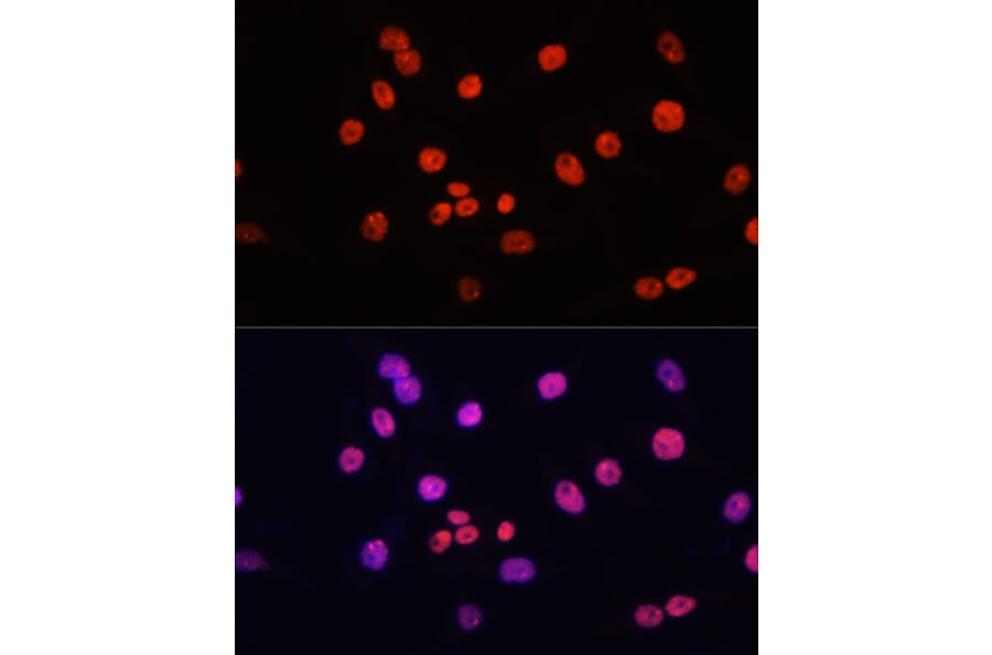 Immunofluorescence - Anti-MYCT1 Antibody (A89021) - Antibodies.com