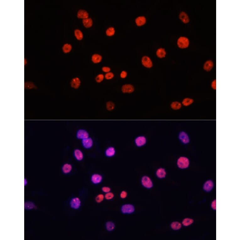 Immunofluorescence - Anti-MYCT1 Antibody (A89021) - Antibodies.com
