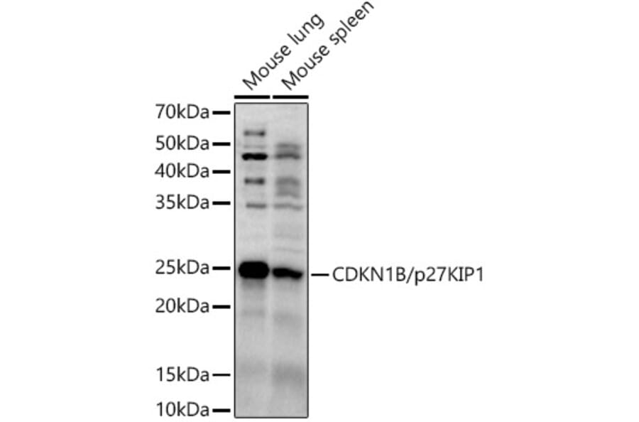 Western Blot - Anti-p27 KIP 1 Antibody (A89022) - Antibodies.com