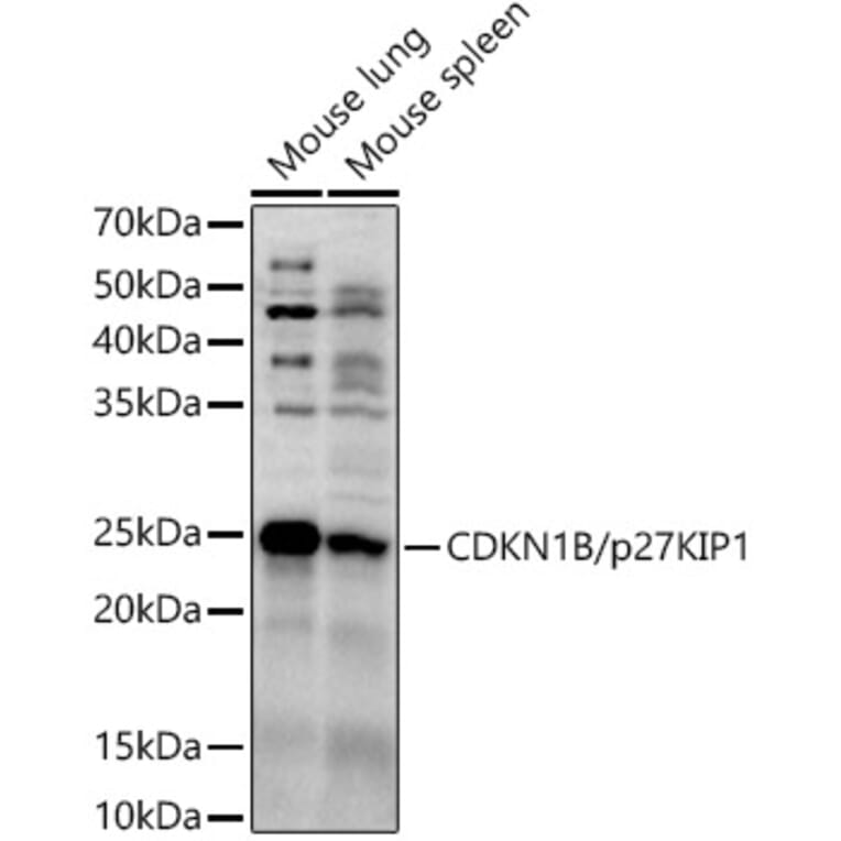 Western Blot - Anti-p27 KIP 1 Antibody (A89022) - Antibodies.com