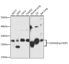 Western Blot - Anti-p27 KIP 1 Antibody (A89023) - Antibodies.com