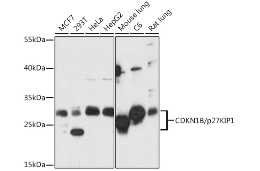 Western Blot - Anti-p27 KIP 1 Antibody (A89023) - Antibodies.com