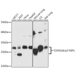 Western Blot - Anti-p27 KIP 1 Antibody (A89023) - Antibodies.com