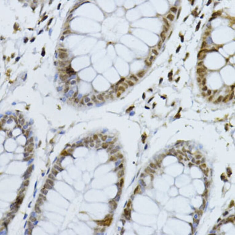 Immunohistochemistry - Anti-p27 KIP 1 Antibody (A89023) - Antibodies.com