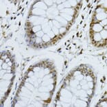 Immunohistochemistry - Anti-p27 KIP 1 Antibody (A89023) - Antibodies.com