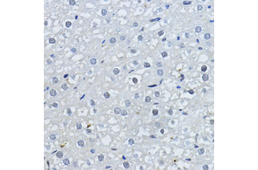 Immunohistochemistry - Anti-p27 KIP 1 Antibody (A89023) - Antibodies.com