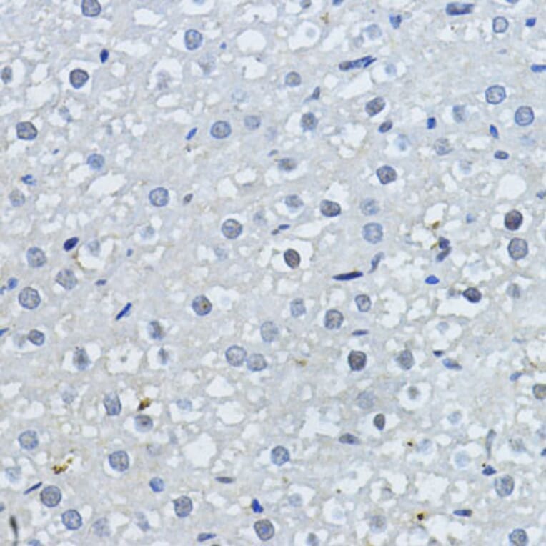 Immunohistochemistry - Anti-p27 KIP 1 Antibody (A89023) - Antibodies.com