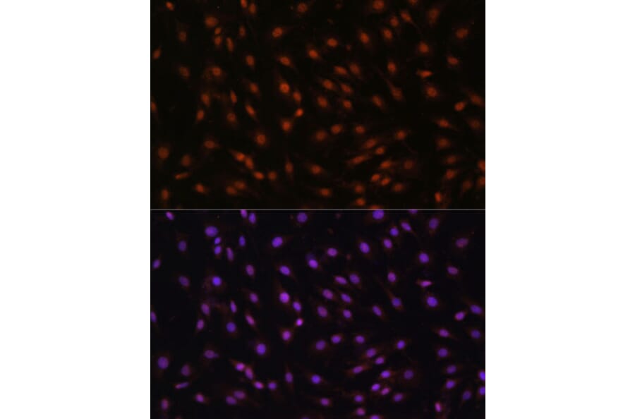 Immunofluorescence - Anti-p27 KIP 1 Antibody (A89023) - Antibodies.com