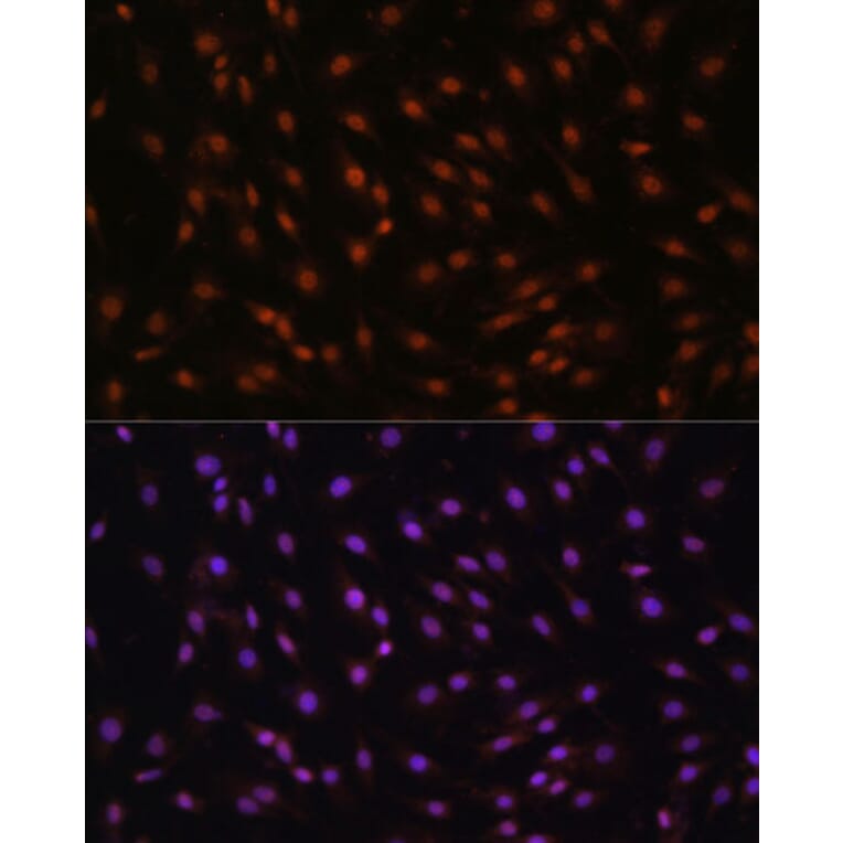 Immunofluorescence - Anti-p27 KIP 1 Antibody (A89023) - Antibodies.com