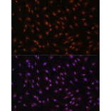 Immunofluorescence - Anti-p27 KIP 1 Antibody (A89023) - Antibodies.com
