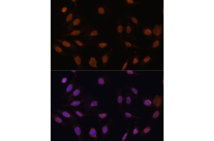 Immunofluorescence - Anti-p27 KIP 1 Antibody (A89023) - Antibodies.com