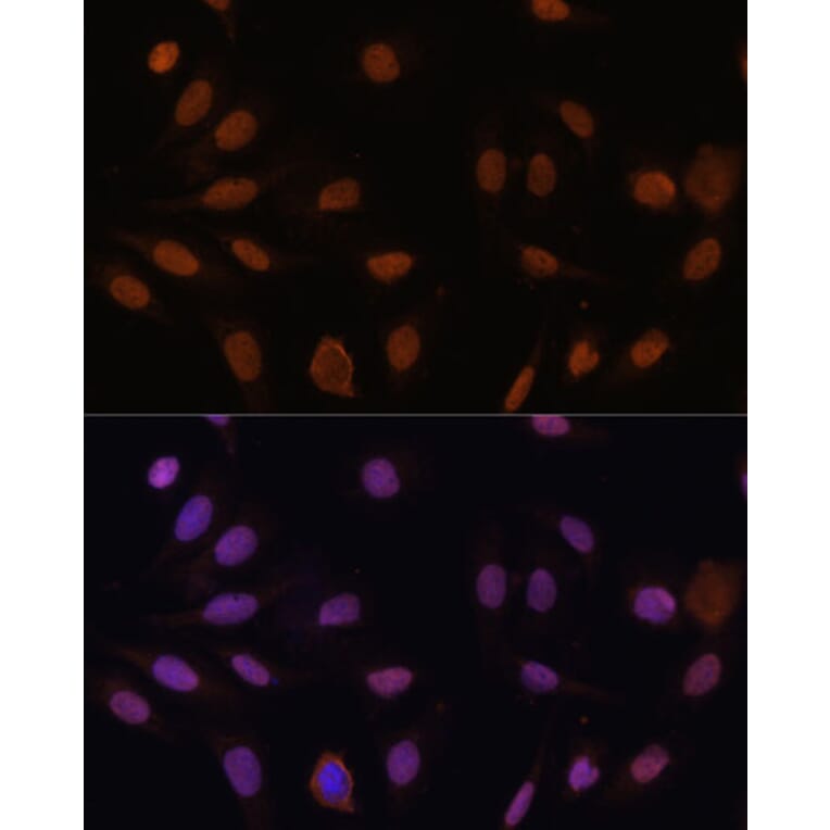Immunofluorescence - Anti-p27 KIP 1 Antibody (A89023) - Antibodies.com