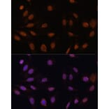 Immunofluorescence - Anti-p27 KIP 1 Antibody (A89023) - Antibodies.com
