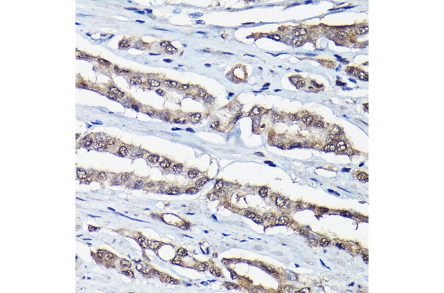 Immunohistochemistry - Anti-DDIT3 Antibody (A89024) - Antibodies.com