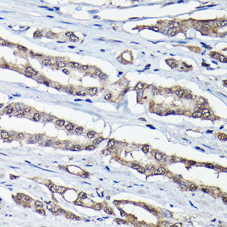 Immunohistochemistry - Anti-DDIT3 Antibody (A89024) - Antibodies.com