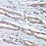 Immunohistochemistry - Anti-DDIT3 Antibody (A89024) - Antibodies.com