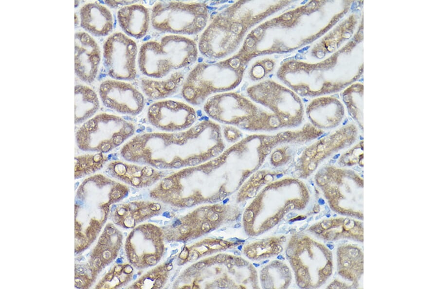 Immunohistochemistry - Anti-DDIT3 Antibody (A89024) - Antibodies.com