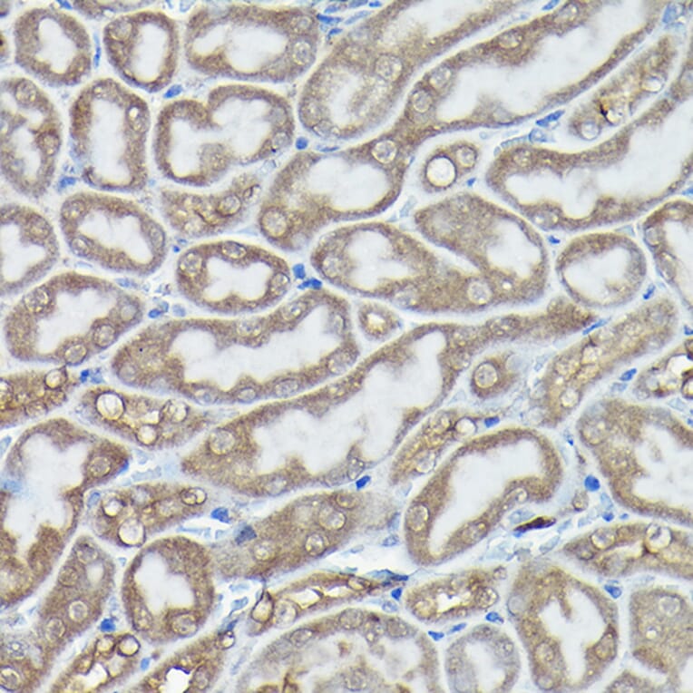 Immunohistochemistry - Anti-DDIT3 Antibody (A89024) - Antibodies.com